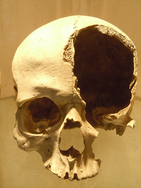 a human skull is shown on display in a museum