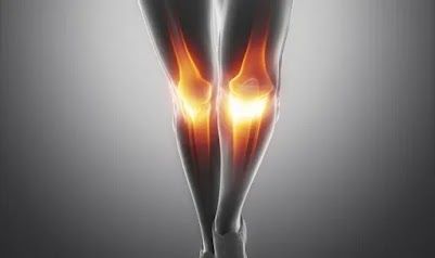 Why does my knee hurt at night? Knee pain can be a common and sometimes mysterious issue, especially for those who experience it at night. Why does it happen? What causes the pain? How can those affected manage or even prevent it?In this article, we'll unlock the mystery of why your knee might hurt at night and explore the causes, symptoms, and treatments available. With this knowledge, you'll gain a better understanding of knee pain and be better prepared to manage it and live a better life.... Stiff Knee, My Knee Hurts, Knee Strengthening Exercises, Aching Legs, Ligament Tear, Live A Better Life, Kinesiology Taping, Adequate Sleep, Leg Pain