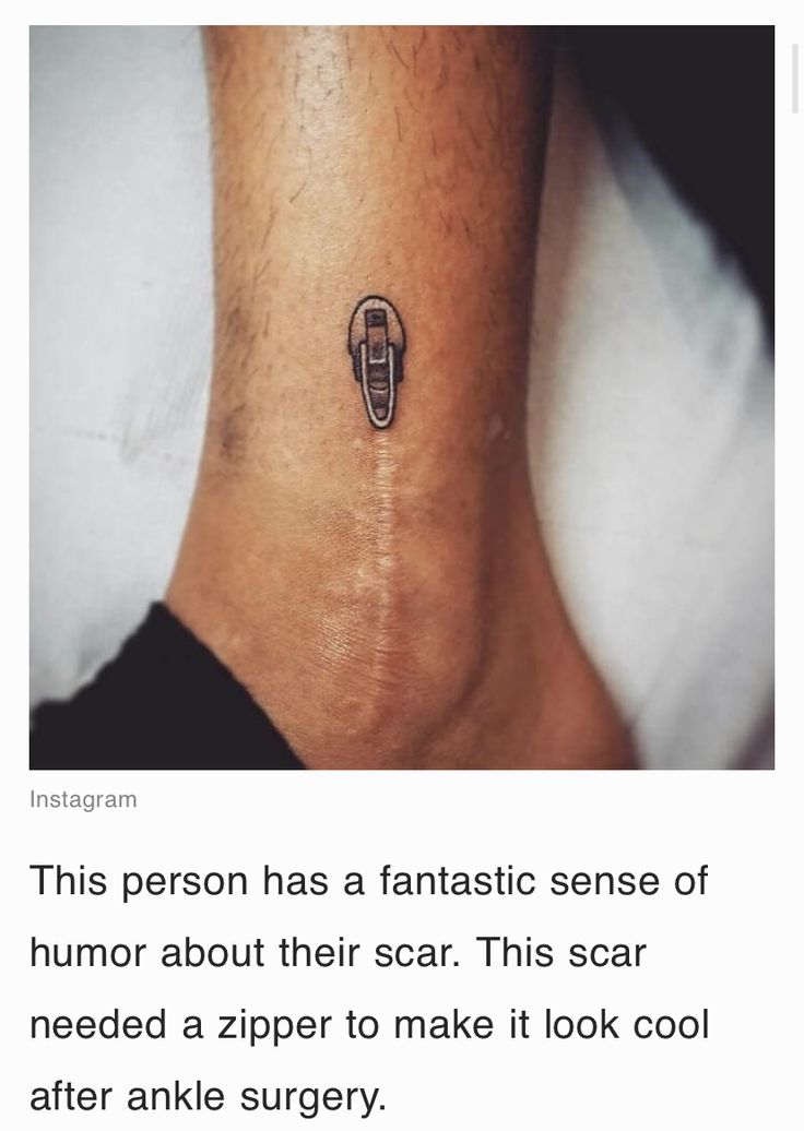 a person has a tattoo on their ankle that reads, this person has a fantastic sense of humor about their scar