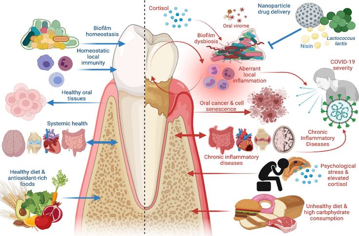 Frontiers | Periodontal Disease: The Good, The Bad, and The Unknown Dental Cleaning, Periodontal Disease, Beneficial Bacteria, Oral Hygiene, Oral Health, Oral Care, Probiotics, Disease