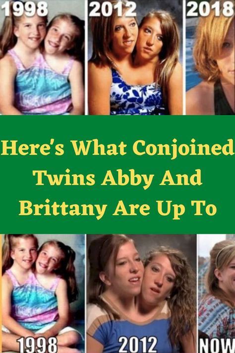 there's what joined twins aby and britain are up to