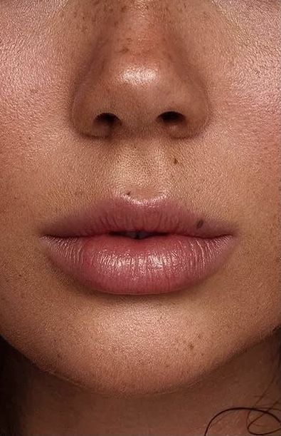 a woman with freckles on her face looking at the camera