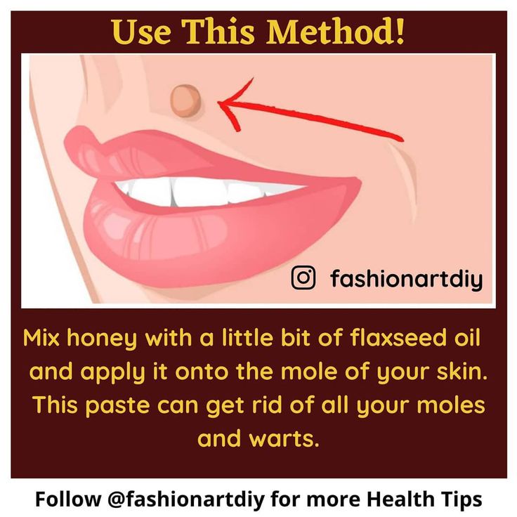 How To Get Red Lips Naturally, Get Red Lips Naturally, Remove Moles, About Skincare, Clear Skin Face, Natural Skin Care Remedies, Natural Face Skin Care, Good Skin Tips, Skin Care Face Mask