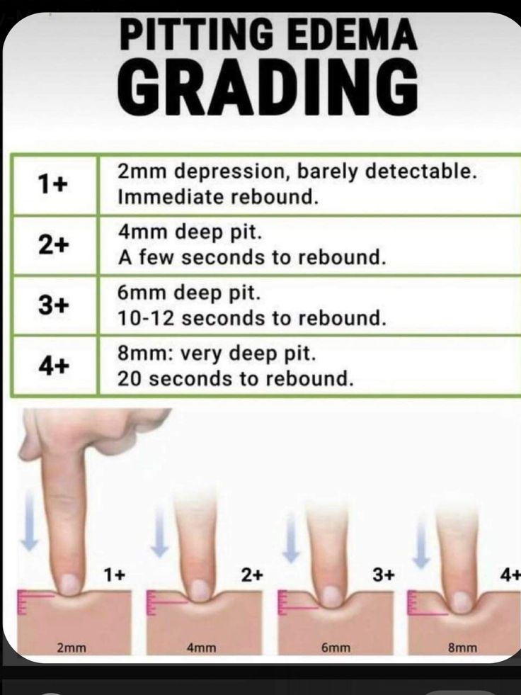 the procedure is shown with instructions on how to get ridding