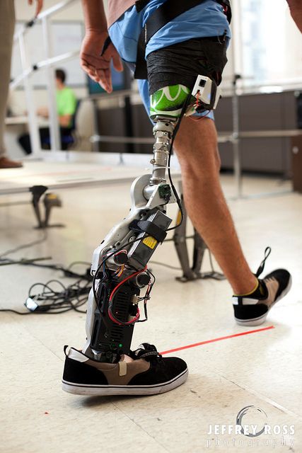 Sfx Prosthetics, Robotic Prosthetics, Bionic Leg, Prosthetic Limbs, Orthotics And Prosthetics, Medical Tech, Prosthetic Leg, Biomedical Engineering, Everyday People