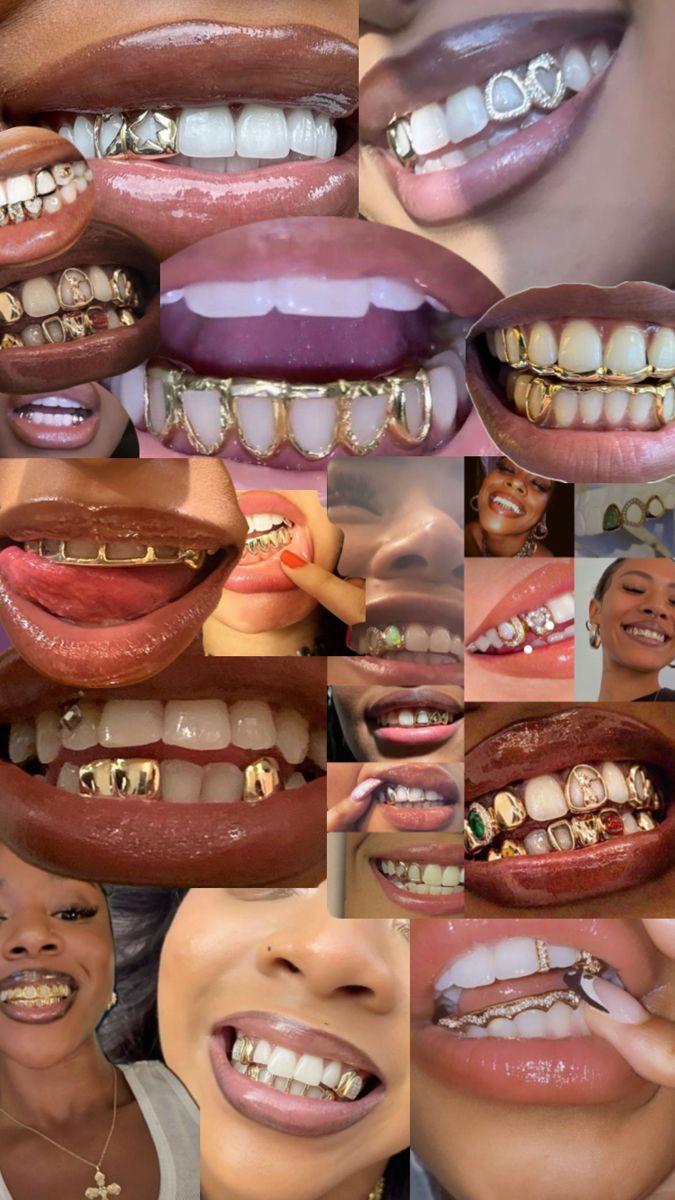 Pretty Teeth, Dental Jewelry, Grillz Teeth, Xoxo Jewelry, Diamond Teeth, Dope Jewelry Accessories, Grills Teeth, Tooth Gem, Gold Teeth