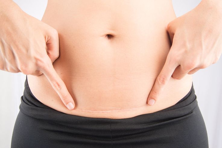 a woman's stomach with her hands on the belly, showing that she is pregnant