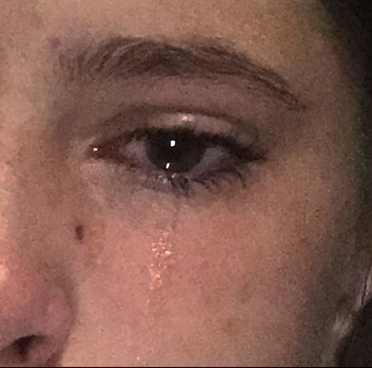 a close up of a woman's face with tears on her eye and nose