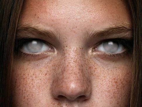 a woman with freckles on her face looking at the camera