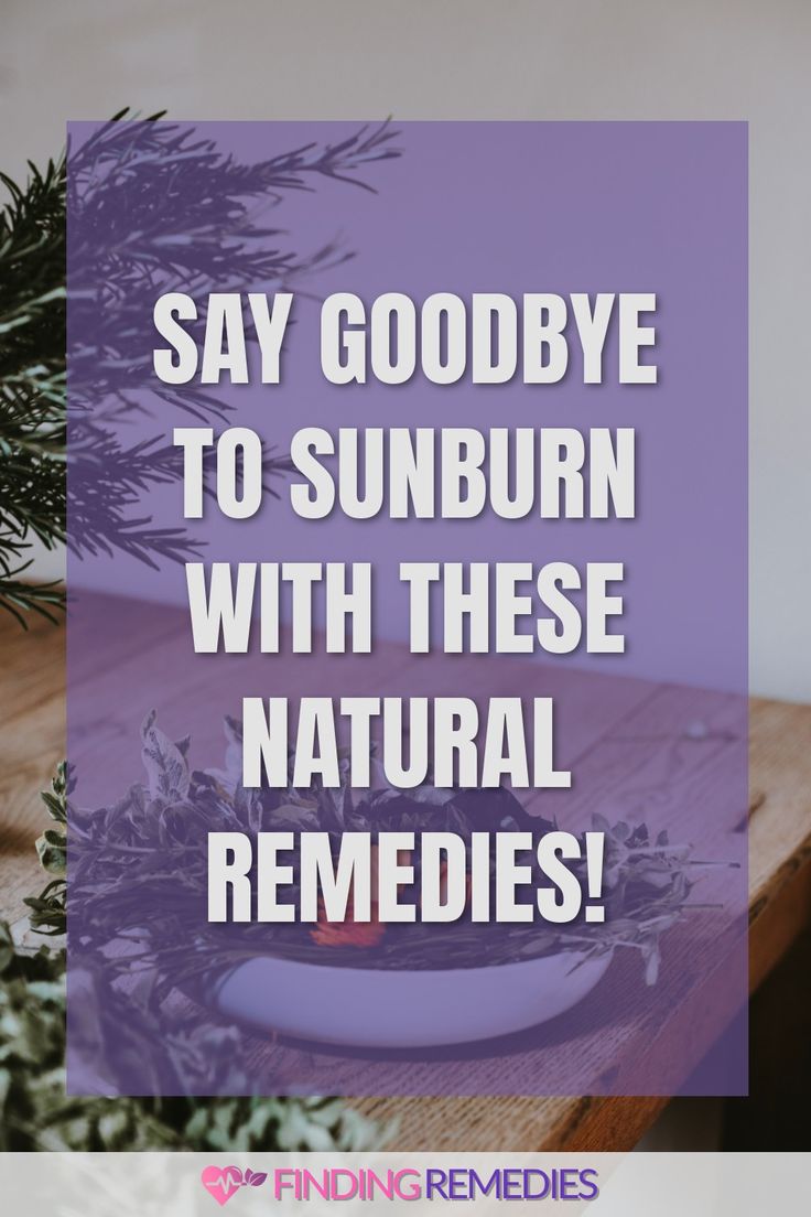 Say Goodbye to Sunburn with These Natural Remedies! How To Help Sunburn, Essential Oil For Sunburn, Home Remedies For Sunburn, Severe Sunburn, How To Treat Sunburn, Burn Remedy, Natural Remedies For Sunburn, Sunburn Remedies, Baking Soda Bath