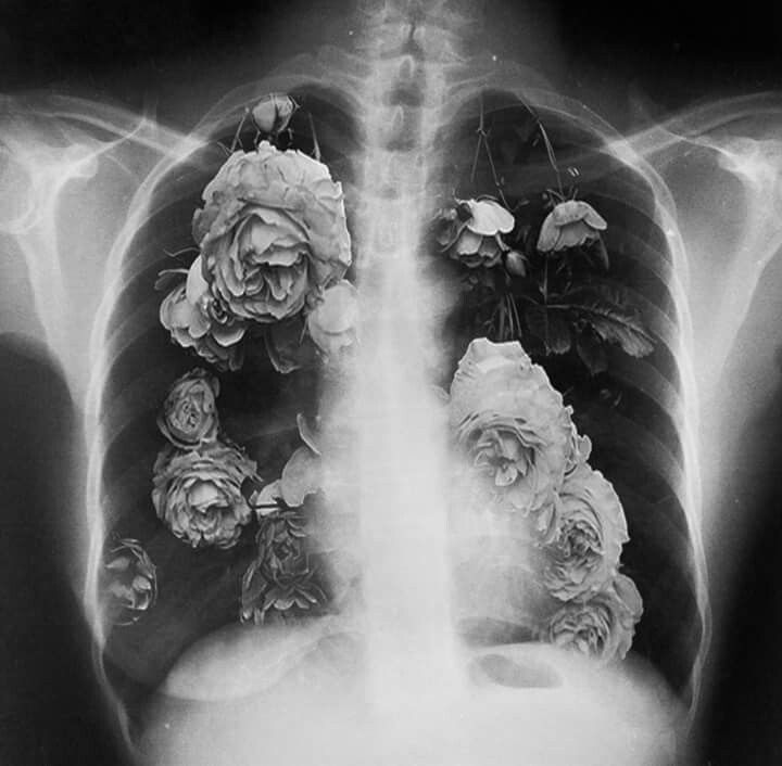 an x - ray shows the chest with flowers growing out of it's ribs