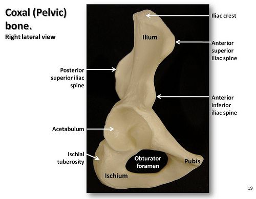 the bones of the lower limb are labeled