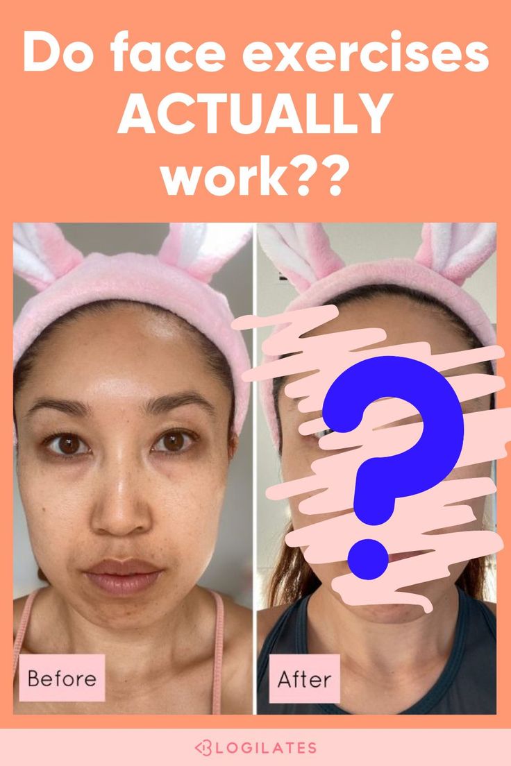 Face Exercises Before And After, Facial Exercises Before And After, Facial Massage Before And After, Blogilates Before And After, Facial Yoga Before And After, Face Tapping, Stretch Routines, Jawline Exercise, Smaller Pores