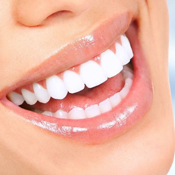 Teeth Aesthetic, Peroxide Teeth Whitening, Pretty Teeth, Teeth Pictures, Veneers Teeth, Beautiful Teeth, Straight Teeth, Perfect Teeth, Smile Teeth