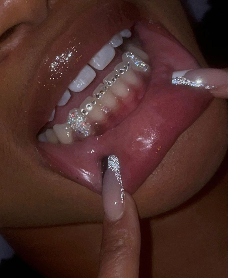 Grill Tooth Gems, Bottom Tooth Gems Ideas, Bottom Teeth Gems, Tooth Gem Inspiration, Toothgems Ideas, Bottom Tooth Gem, Teeth Rhinestones, Teeth Gems Ideas, Tooth Gems Bottom Teeth