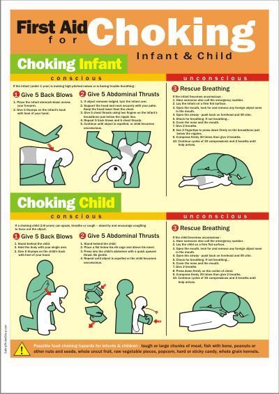 choking first aid on infant | Poster Title : First Aid For Choking Infant And Child First Aid Poster, Infant Cpr, Convertible Stroller, First Aid Tips, Baby Information, Safety Posters, Abdominal Fat, Medical Knowledge, Baby Time