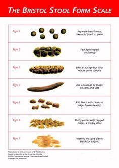 The Bristol Stool Form Scale or Bristol Stool Chart is a seven group classification of the form that appears upon defecation of human feces. Bowel Movement Chart, Bristol Stool, Bristol Stool Chart, Stool Chart, Large Bowel, Bladder Control, Bowel Movement, Irritable Bowel, Sugar Detox