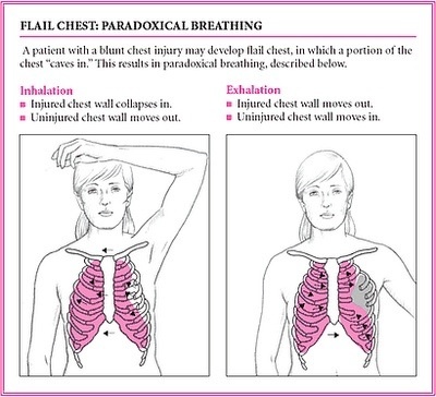 the diagram shows how to treat chest pain