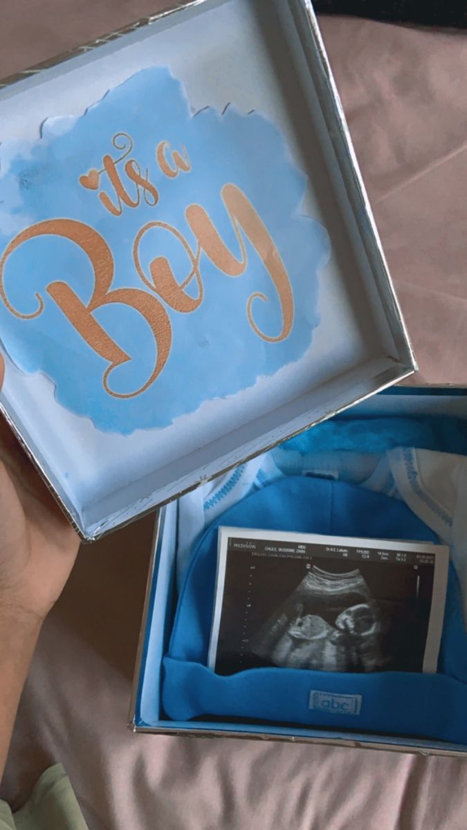 a person is holding up a box with an x - ray in it and there is a baby's diaper inside