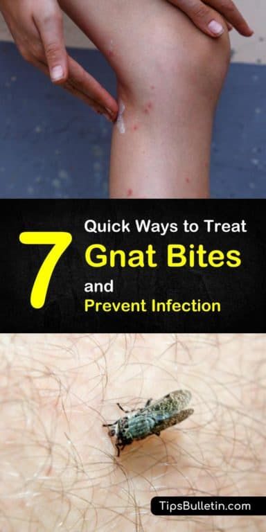 an image of a bug on someone's leg with the title 7 quick ways to treat gnat bites and prevent infection