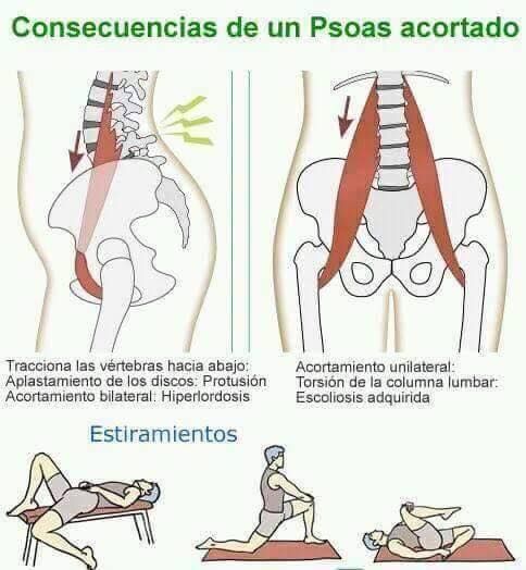 a poster explaining how to do yoga for back pain