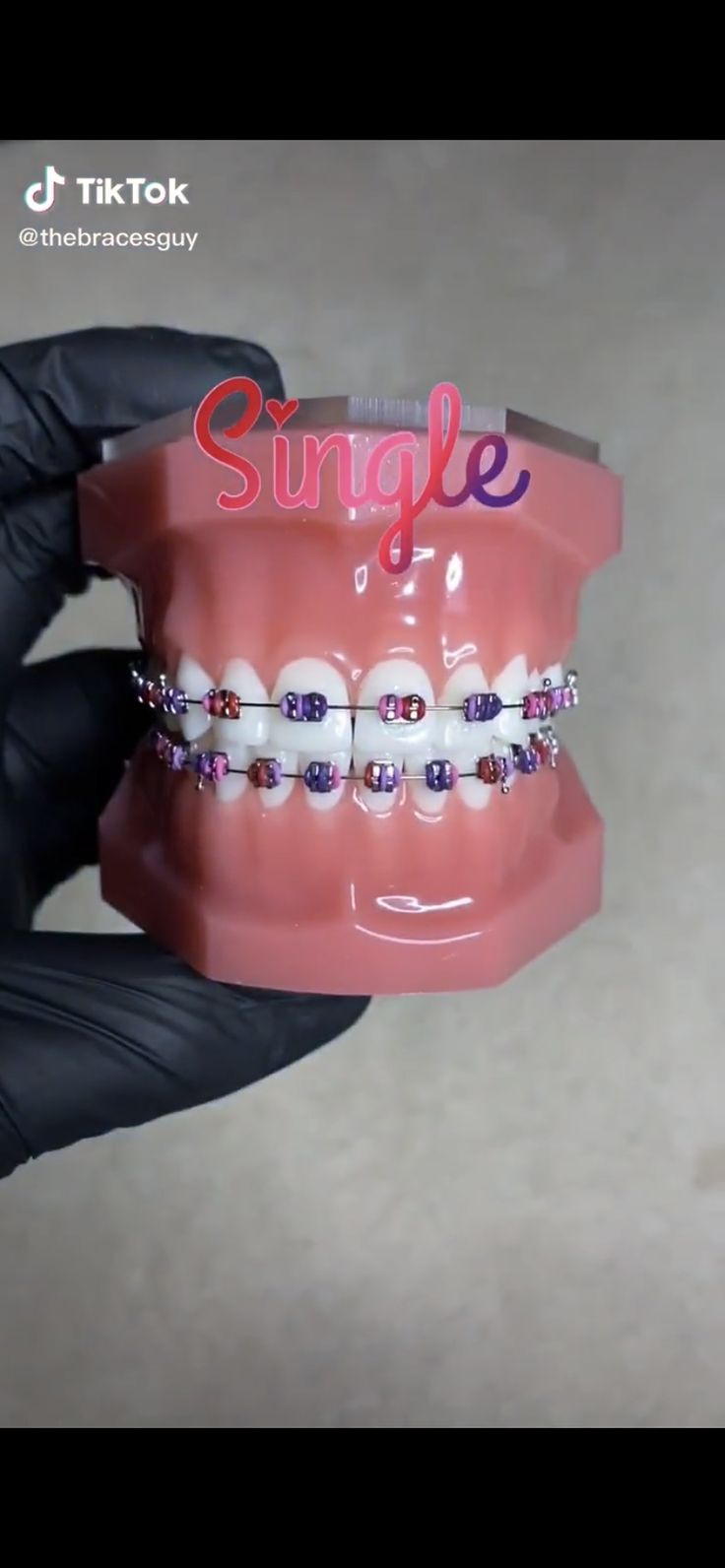 Valentines Braces Colors, Hot Pink And Light Pink Braces, Powerchain Braces Colors Ideas, Braces Colors Ideas Power Chains, Valentine’s Day Braces Colors, Powerchain Braces Color, Braces Colors Combinations, Dental Braces Colors, Cute Braces Colors