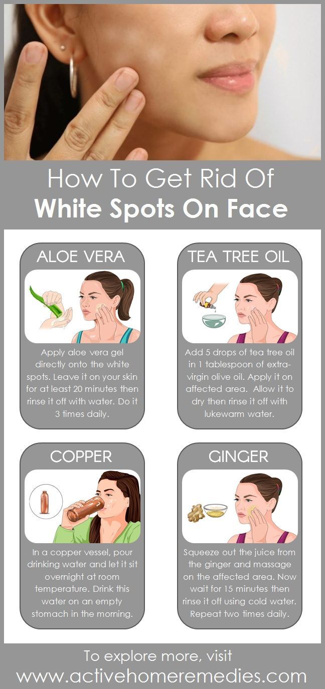 White Spots On Face, White Skin Spots, Diy Skin Care Products, Tips For Eyebrows, Brown Age Spots, Winter Beauty Tips, Spots On Skin, Skin Care Ideas, Face Care Tips