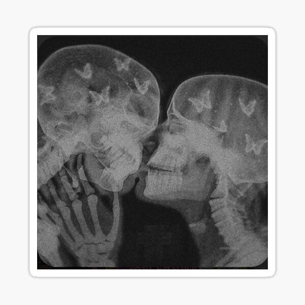 an x - ray image of two people kissing with butterflies on their heads and shoulders