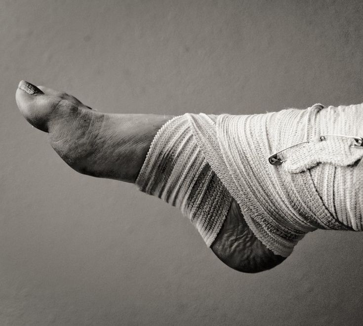 a person with bandages wrapped around their ankles and foot in black and white photo, taken from above