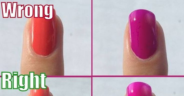 Toe Nail Color, Pedicure Designs, Manicure Tips, Nail Fungus, Dry Nails, Nail Health, Diy Beauty Hacks, Manicure Y Pedicure, Healthy Nails