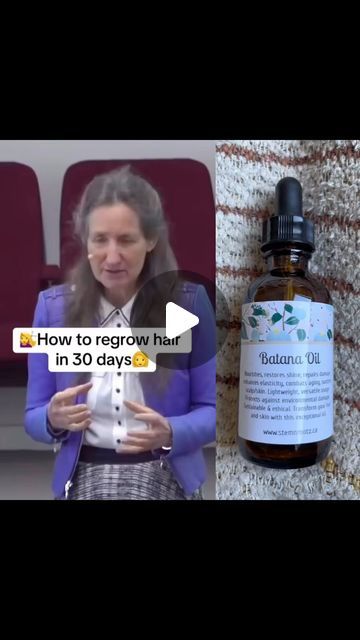 How To Use Batana Oil For Hair Growth, Best Hair Vitamins For Hair Growth, Batana Oil Hair Growth, Batana Oil Before And After, Batana Oil Benefits, Hair Strengthening And Growth, Hairline Growth, Party Ponytail, Dry Flaky Scalp