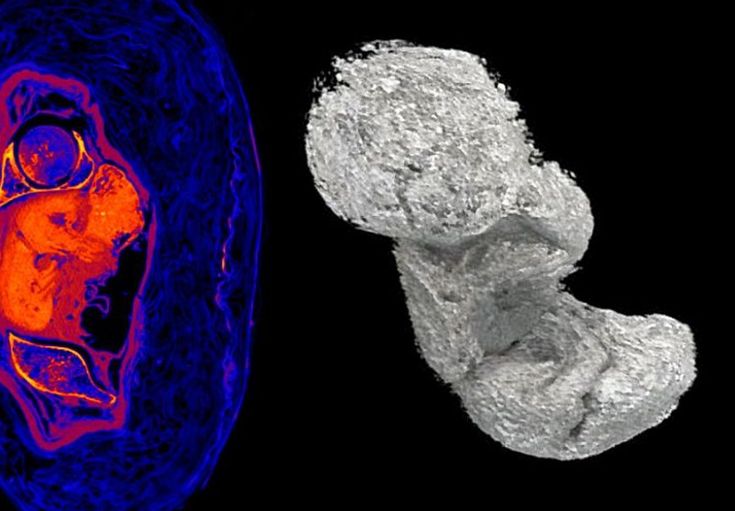 an image of the inside of a human head and its surroundings are shown in infrared colors