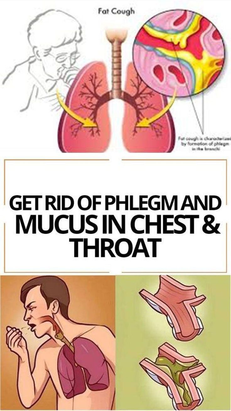 Mucus accumulations make you feel as if there’s something stuck in your throat. You sense an urge to clear your throat, and it’s really frustrating. This problem is usually created by infections in the upper respiratory tract, but mucus accumulations may be triggered by allergies, asthma, and he... Mucus In Chest, Chest Congestion Remedies, Mucus Relief, Getting Rid Of Phlegm, Home Remedies For Bronchitis, Sinus Congestion Relief, Toddler Cough Remedies, Congestion Relief, Sinus Congestion