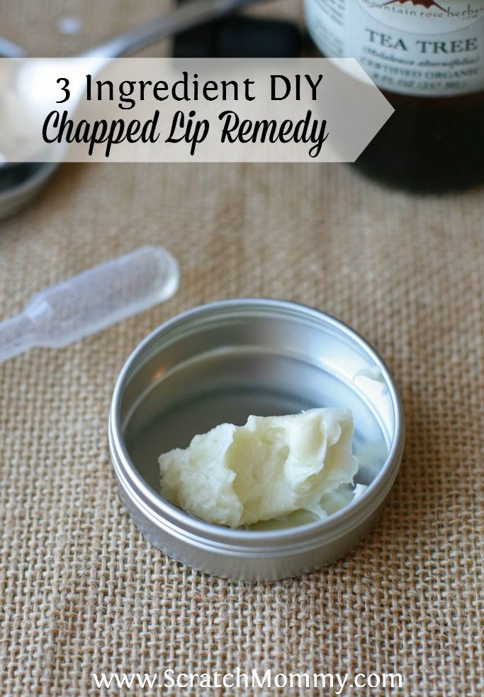 Are your lips in pain from being chapped or sun burnt? Here's a SUPER SIMPLE, 3 ingredient DIY chapped lip remedy made with natural ingredients. Chapped Lips Remedy, Diy Products, Diy Lips, Body Butters, Beauty Diy, Smooth Lips, Flaky Skin, Homemade Remedies, Diy Body