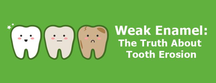 Learn what causes enamel loss and how to prevent tooth erosion. If you are experiencing this issue, visit us online to learn more! Teeth Enamel Repair, Tooth Enamel Repair, Teeth Remedies, Heath Tips, Dental Marketing, Tooth Enamel, Family Dental, Diy Remedies, Natural Teeth