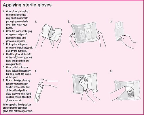 instructions for applying sterile gloves on hands