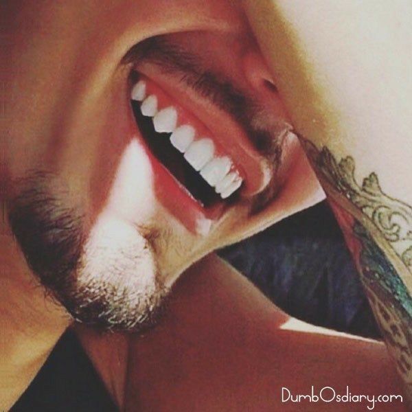 a man with his mouth open showing teeth and piercings on it's side