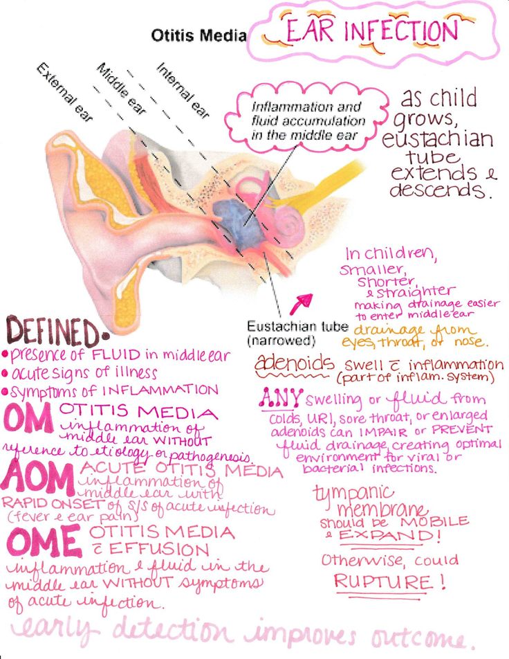 Ent Medical Notes, Nursing School Pediatric Notes, Otitis Media Nursing, Ent Notes, Pediatric Nursing Study, Charting For Nurses, Nursing School Organization, Ear Diseases, Nurse Teaching