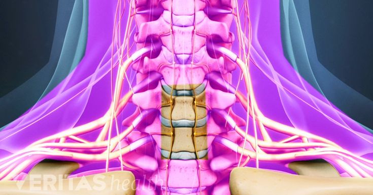 Acdf Surgery, Spinal Degeneration, Spinal Fusion Surgery, Cervical Disc, Cervical Pain, Cervical Spondylosis, Spinal Fusion, Spinal Decompression, Spinal Surgery