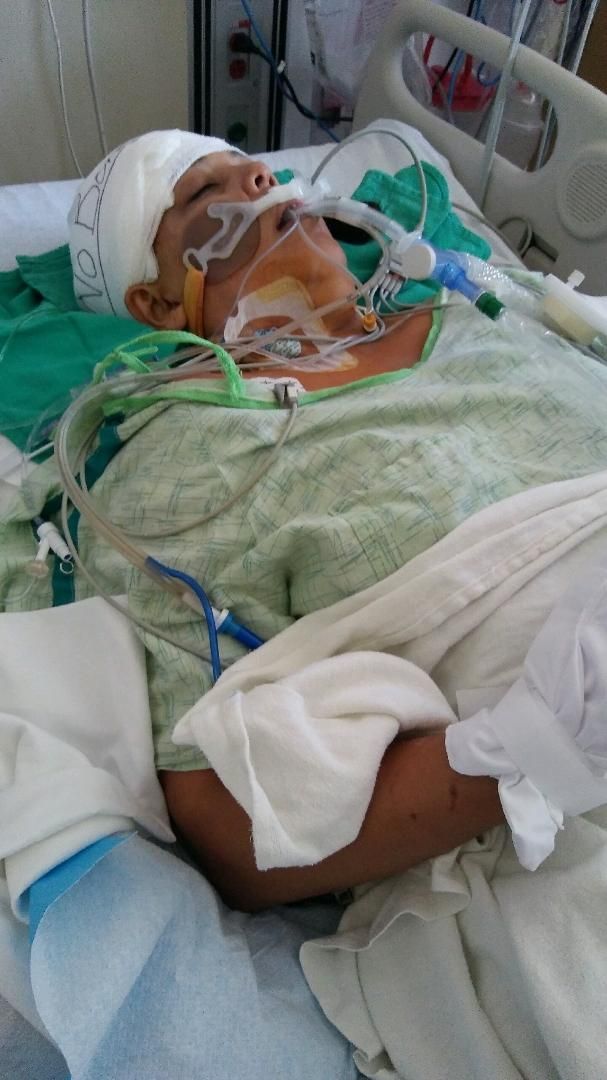 a man laying in a hospital bed with an oxygen tube attached to his face and head