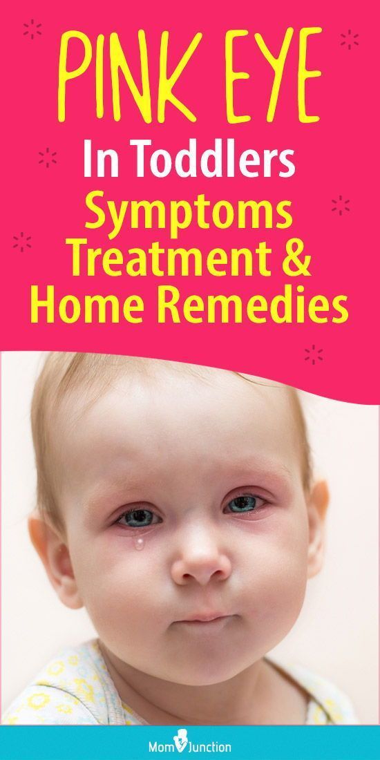 5 Eye Problems To Never Ignore Natural Remedies For Pink Eye In Kids, Pinkeye Remedies Natural, Pink Eye In Kids, Viral Pink Eye Remedy, Pink Eye Remedy For Kids, Pink Eye In Toddlers, Red Eyes Remedy, Pink Eye Remedies, Pink Eye Remedy