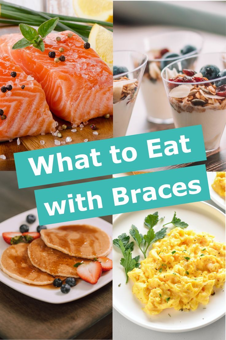 Good Food To Eat With Braces, Braces Food Ideas Meals, Soft Food Braces Ideas, Meals For Braces Dinners, Meals For People With Braces, Dinner Ideas For Braces Soft Foods, Lunch Ideas For Braces, Soft Foods After Braces Ideas, Braces Meal Ideas