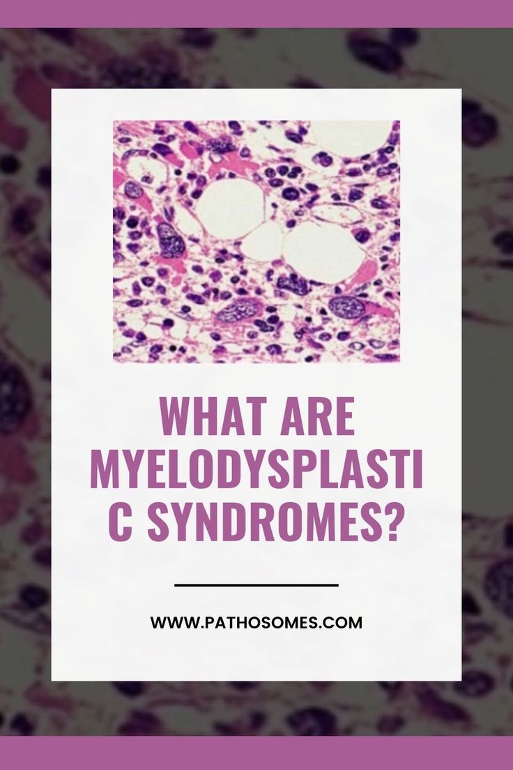 Myelodysplastic syndromes are a group of cancers in which immature blood cells in the bone marrow do not develop into mature blood cells. These cells stay within the bone marrow in an immature state. “Myelodysplastic” come from “myelo” which means blood cells and “dysplastic” which means abnormal cell development or growth. Abnormal Cells, Bone Marrow, Blood Cells, The Bone, A Group, Disease, Book Cover