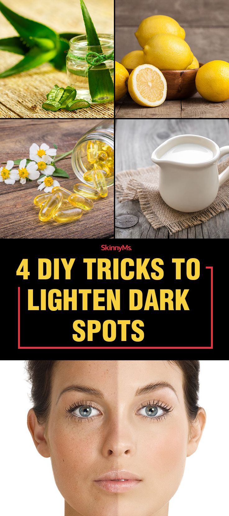 4 DIY Tricks To Lighten Dark Spots Dark Spots Under Armpits, Dark Spots On Legs, Dark Spots Remedies, Spots On Legs, Exfoliating Face Scrub, Dark Spots On Face, Beach Blonde, Face Scrub Homemade, Spots On Face