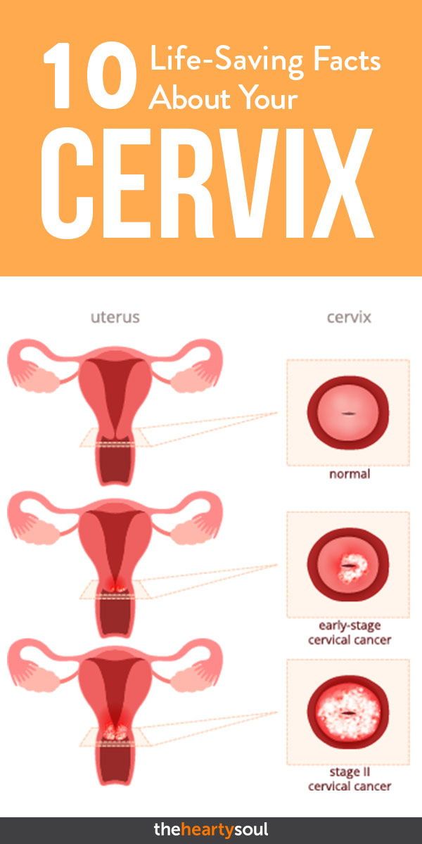 Cervix Pictures, Medical Knowledge, Women's Health, Natural Living, Belleza Natural, Real Food, Saving Lives, New Ideas, Rainy Days