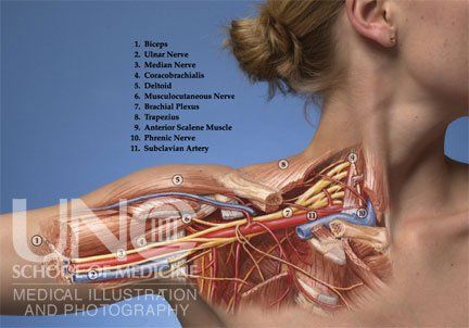 Brachial Plexus Tattoo, Thoracic Outlet, Brachial Plexus, Median Nerve, Human Body Anatomy, Muscle Anatomy, Medical Anatomy, Chandler Az, Food Sensitivities