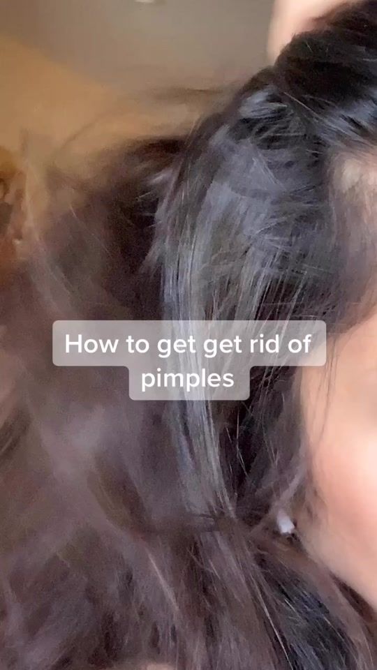 Get Rid Of Pimples, Rid Of Pimples, Haut Routine, Good Skin Tips, How To Get Rid Of Pimples, Beauty Routine Tips, Beauty Tips For Glowing Skin, Clear Skin Tips, Perfect Skin Care Routine