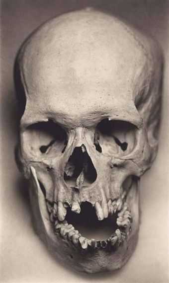 a black and white photo of a human skull