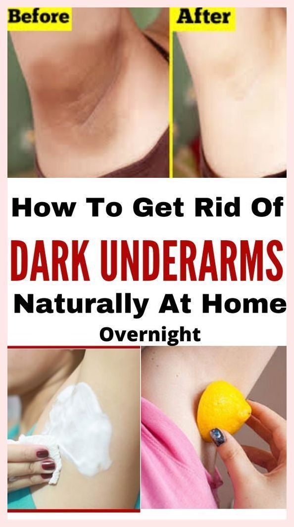 How To Whiten Underarms Fast and Naturally Whiten Underarms Fast, Rid Of Dark Underarms, How To Whiten Underarms, Dark Armpits, Lifting Facial, Dark Underarms, Magnesium Deficiency, Unwanted Hair Removal, Homemade Remedies