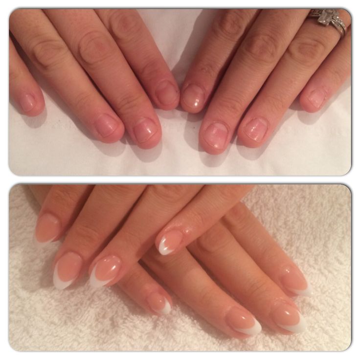 Before and after nail biter acrylic nails Nails For Nail Biters, Best Fake Nails, Types Of Fake Nails, Nails After Acrylics, Infinity Nails, Spring Acrylic Nails, Nail Pictures, Polygel Nails, Vibrant Nails